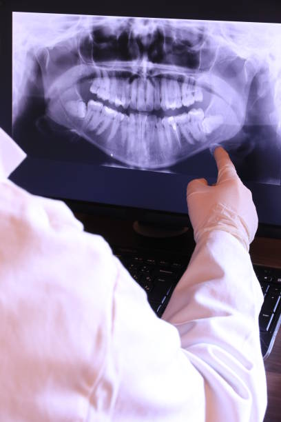 Best Emergency Root Canal Treatment in Cameron Park, TX