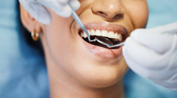 Best Urgent Care for Lost Fillings or Crowns in Cameron Park, TX