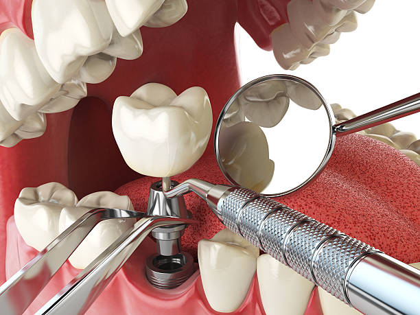 Best Emergency TMJ Treatment in Cameron Park, TX