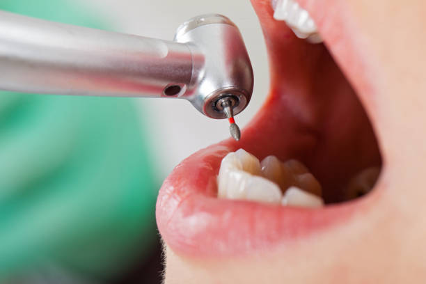 Best Pediatric Emergency Dentist in Cameron Park, TX